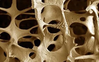 wpid-osteoporosi.jpg - Liveuniversity