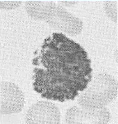 Alcuni tipi di leucociti si distinguono per la differente colorabilità dei granuli che contengono. Il leucocita in figura è stato colorato con un colorante basico. Di che tipo di leucocita si tratta?