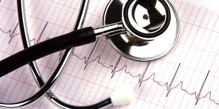 a stethoscope over a electrocardiogram close up