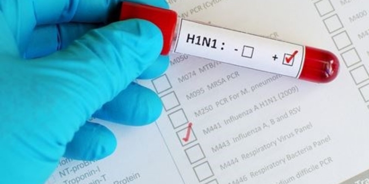 sicilia influenza suina h1n1