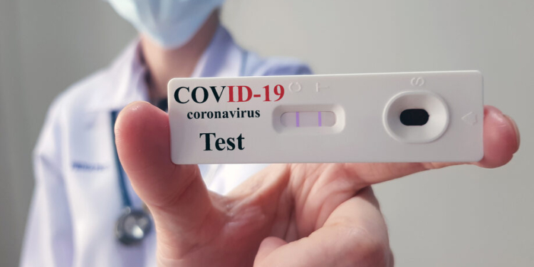 coronavirus sicilia test sierologico