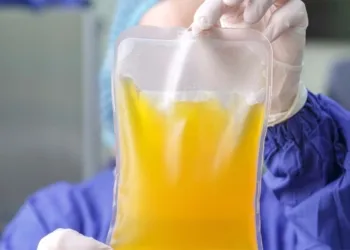 plasma iperimmune coronavirus